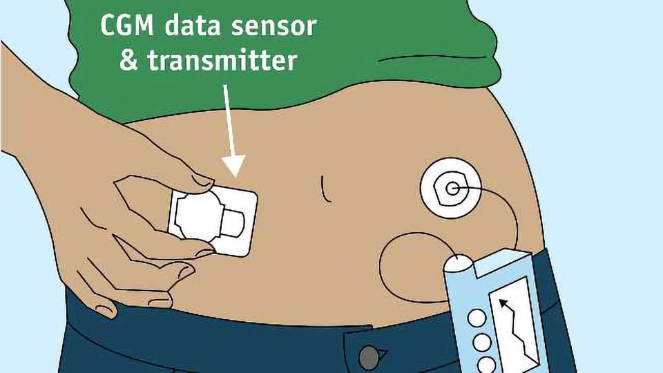 CGM Animation
