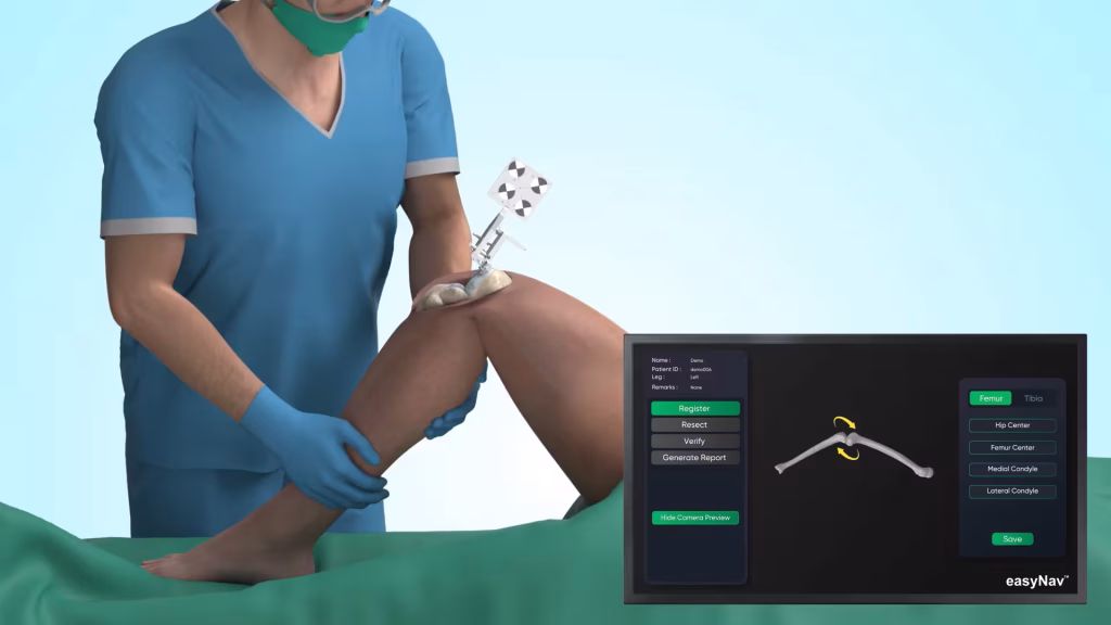 Total-Knee-Replacement-Surgery-Machine-Promotional-Video