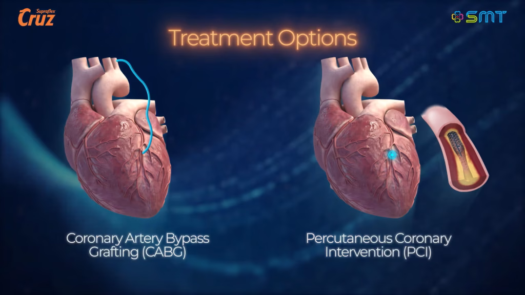 Coronary Artery Disease Animation Video