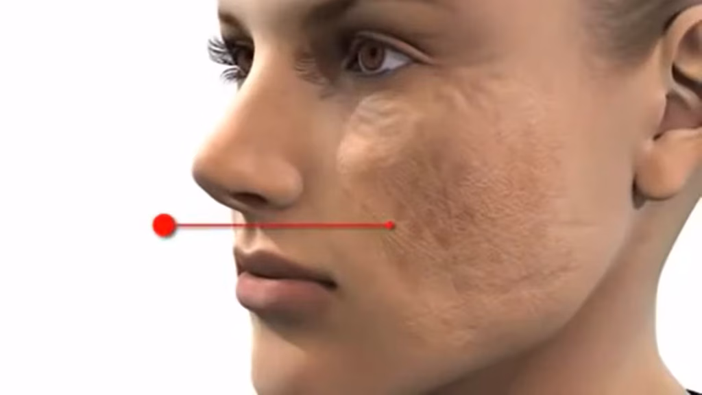 Skin-Aging-Process-Explained-with-3D-Video-Animation-Case-Study